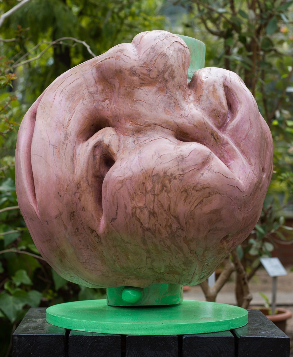 großer Tumor